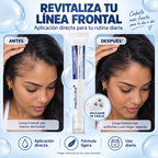 Medicube Deoxyribose - Sérum para Raya y Cuero Cabelludo